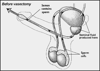narząd rozrodczy przed wazektomią