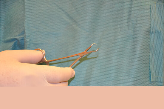 Fenestrated foreceps used for grasping the vas deferens.