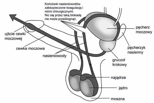po zabiegu wazektomii